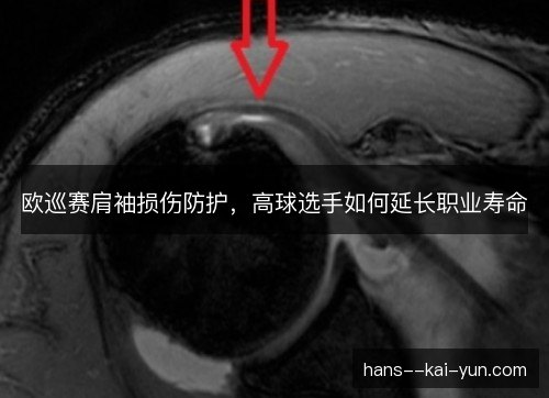 欧巡赛肩袖损伤防护,高球选手如何延长职业寿命 欧巡赛肩袖损伤防护,高球选手如何延长职业寿命